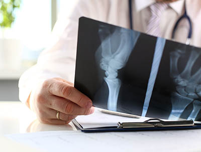 Male doctor hold in arm silver pen and look at xray photography closeup. Skeleton bone disease exam medic aid or cancer physical test in hospital for healthy lifestyle education career concept